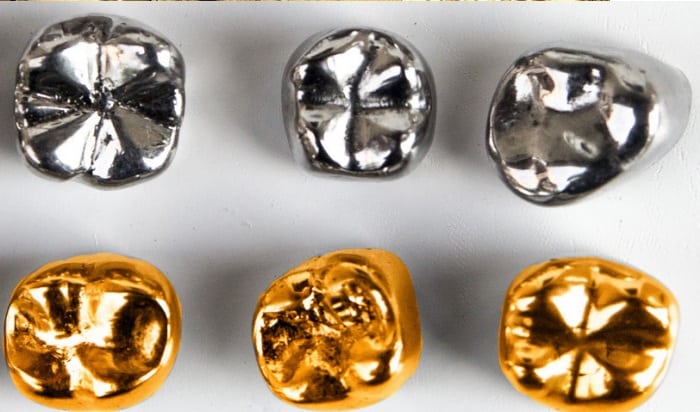 gold and bridge – 19dec2019 – 3
